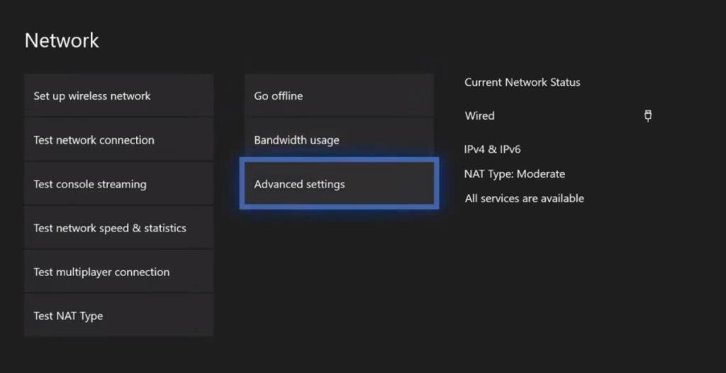 Cara Memperbaiki Kesalahan UPnP Tidak Berhasil di Xbox